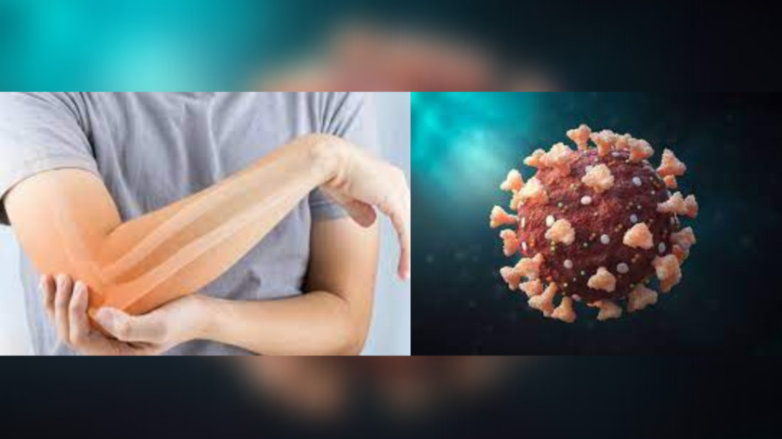 Covid Infection May Induce Severe Bone Loss, Study Suggests
