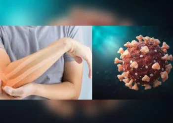 Covid Infection May Induce Severe Bone Loss, Study Suggests