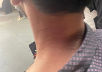 KU Law Student Injured In Scuffle At Campus