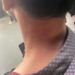 KU Law Student Injured In Scuffle At Campus
