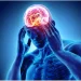 Study Finds Lidocaine Infusions Could Assist Migraine Sufferers