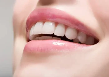 White Teeth Does Not Mean Good Teeth