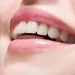 White Teeth Does Not Mean Good Teeth