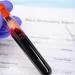 Lab-Grown Blood Given To People In World-First Clinical Trial