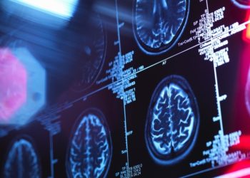 Alzheimer’s drug lecanemab hailed as ‘momentous’ breakthrough