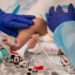 Hepatitis Outbreak: One More Minor Dies In Anantnag Village, Toll 02