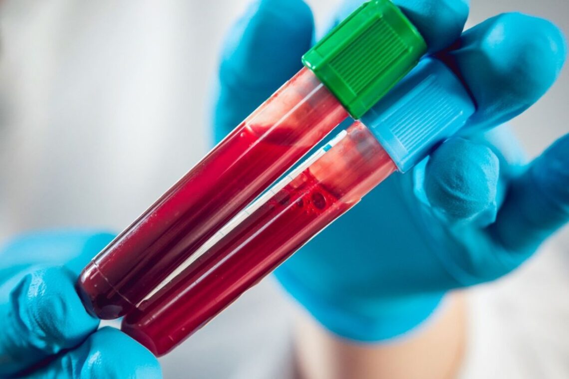 Centre Directs States To Conduct Genome Sequencing Of Covid Positive Samples To Track Variants