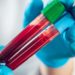 Centre Directs States To Conduct Genome Sequencing Of Covid Positive Samples To Track Variants
