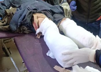 Man Jumps In Front Of Moving Train In Anatnag, Loses Both Limbs