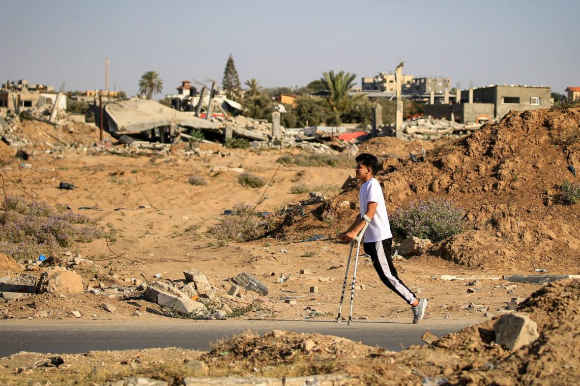 10 Children Suffer Amputations Daily In Gaza, Says UNRWA