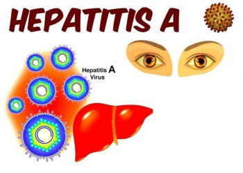 Hepatitis-A Cases Among Children Detected In North Kashmir’s Bandipora