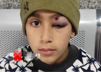 Headmaster Booked For Physically Assaulting Student In North Kashmir’s Bandipora