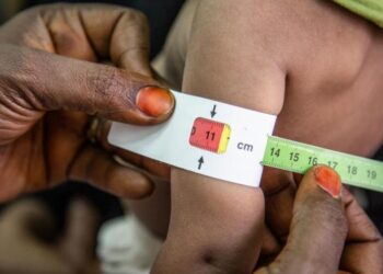 Over 1.14 Lakh Children Suffering From Malnutrition In J&K