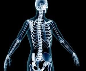 Osteoporosis A ‘Silent Threat’ To Bone Health: Doctors