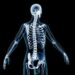 Osteoporosis A ‘Silent Threat’ To Bone Health: Doctors