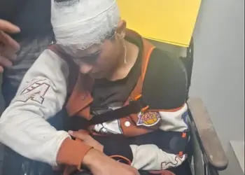 Young Kashmiri Shawl Seller Injured in Mob Attack in Uttarakhand