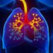 Asthma is a Lifelong Disease, Needs Consistent Medical Care: Experts